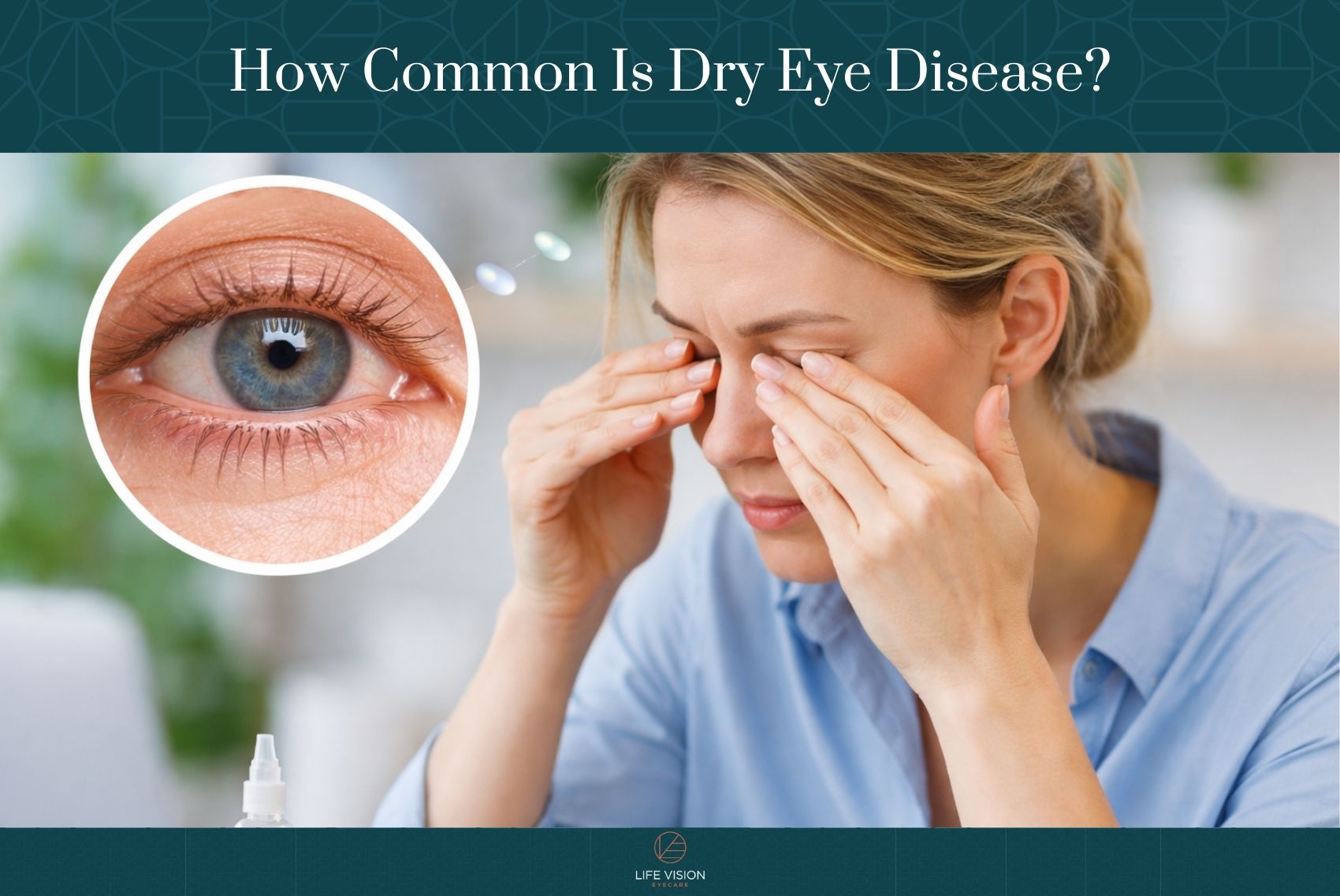 How Common Is Dry Eye Disease?