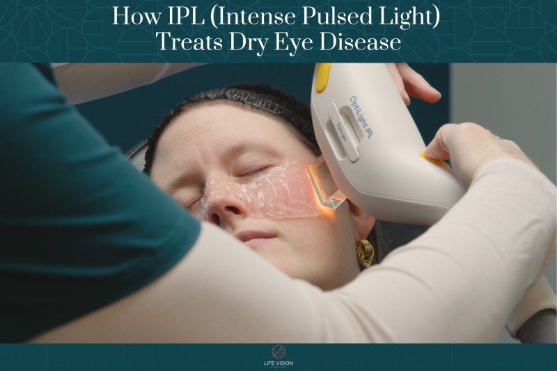 How IPL (Intense Pulsed Light) Treats Dry Eye Disease (2)