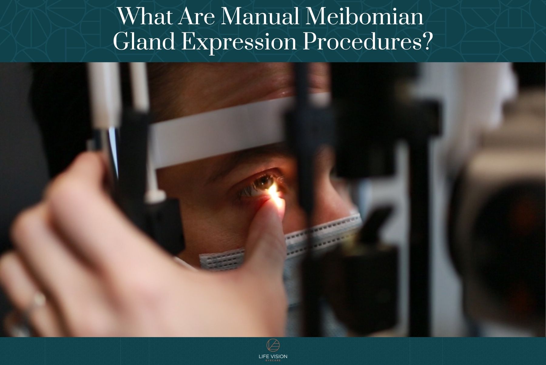 What Are Manual Meibomian Gland Expression Procedures